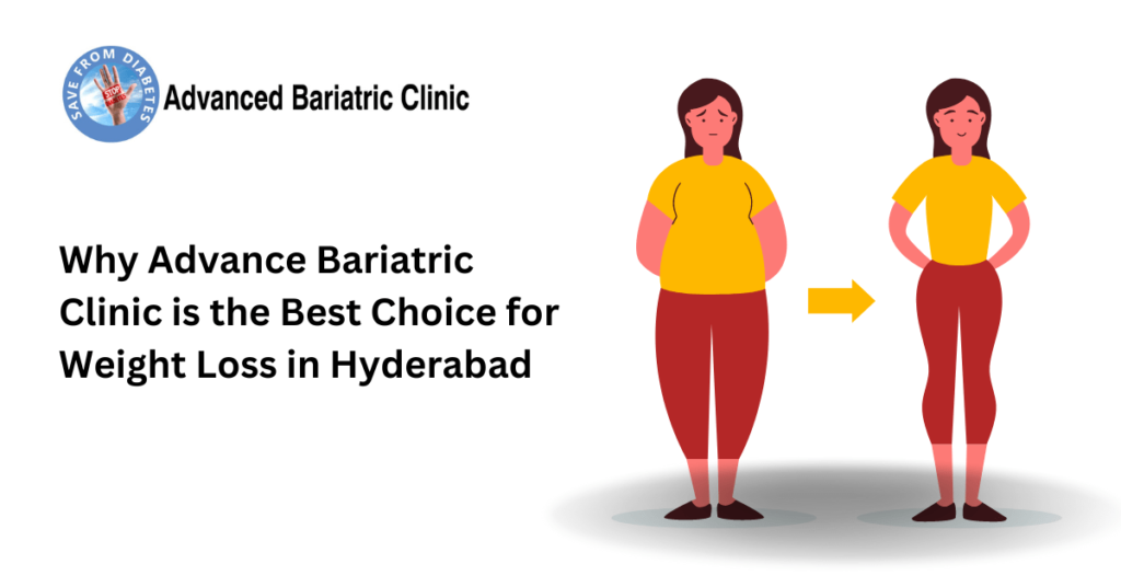 Why Advance Bariatric Clinic is the Best Choice for Weight Loss in Hyderabad